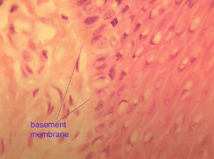 Sezione istologica della pelle con membrana basale visibile, struttura chiave del tessuto connettivo ricco di collagene